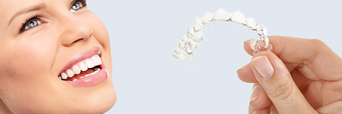 Katy 7 Things Parents Need to Know About Invisalign Teen